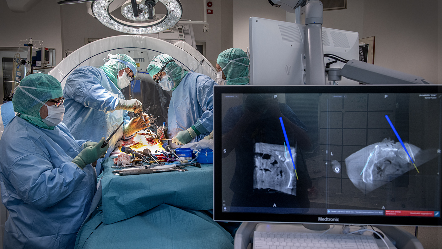 Operationssjuksköterskan Maria Persson och ST-läkaren Viktor Edin jobbar  tillsammans med Marek Holy och Gauti Sigmundsson under en av  ryggoperationerna.